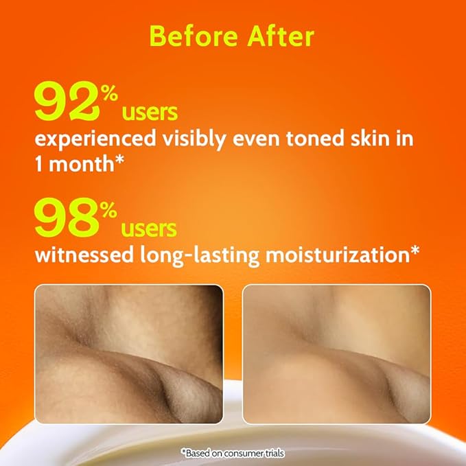 Chemist at Play AHA Body Lotion with 5% Natural AHA, Niacinamide, Shea Butter | For Exfoliating Dry & Dead Skin Cells, Deep Nourishment & Radiant Skin | AHA Lotion | 236ml