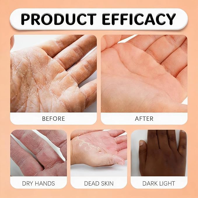 Retinol Hand Cream Anti Aging, Hydrating & Moisturizing Hand Lotion with Anti-Aging Formula to Help Prevent Wrinkles & Reduce Fine Lines (50G Intense Hand Cream With Retinol for Dry Hands)