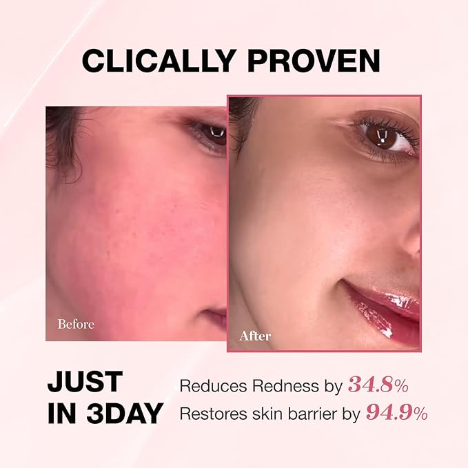 PHYSIOGEL Redness Reducing Cream – Ceramide Moisturizer for Dry, Sensitive & Redness-Prone Skin, Repairs Skin Barrier, Dermatologist-Tested, Fragrance-Free, Korean Skincare, 1.69 fl oz