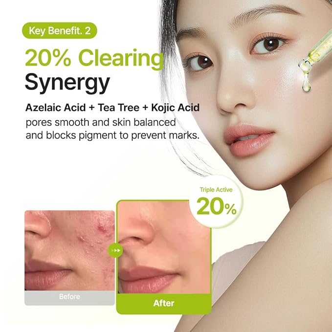 PURITO Azelaic Acid 10% + Kojic Acid + Tea Tree Facial Serum | for Blemish-Prone, Oily & Sensitive Skin | Redness Soothing | Korean Skincare, 30mL 1.01 fl.oz