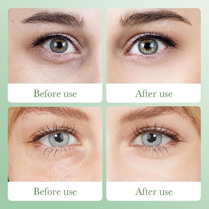 Aloe Vera Eye Masks - 60 PCS Under Eye Patches for Puffiness & Dark Circle, Moisturizing Firming Eyes Gel Pad Patches for Bag Puffiness Daily Skincare, Gifts for Women