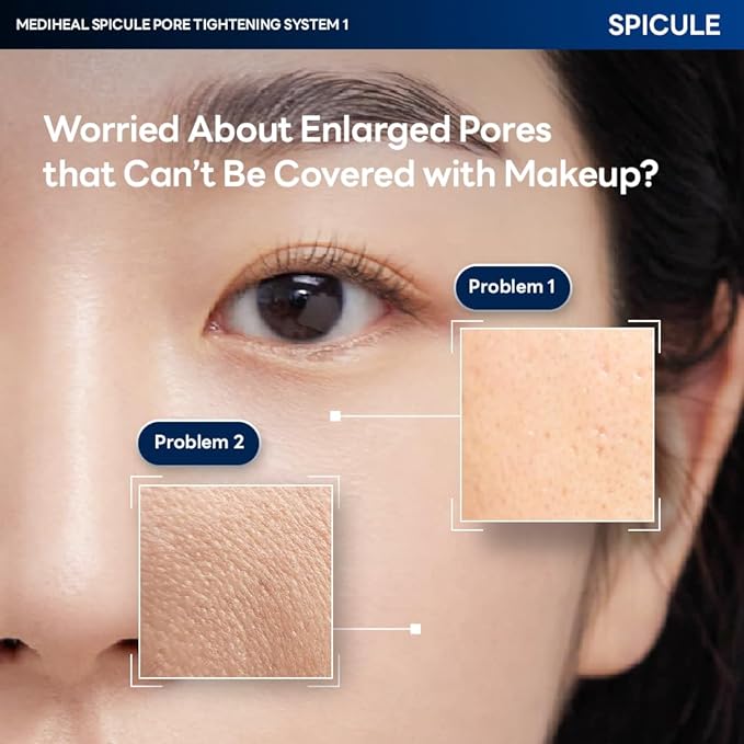 Mediheal Collagen Spicule 1000ppm Intensive Serum – Micro Needle Serum for Pore Care, Soothing & Skin Texture Improvement, 2-Step,Collagen Spicule Ampoule and Gel Mask Set,Skin Booster,10pcs