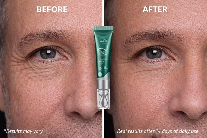 Lifting Power Eye Fluid – Eyelid Lifting Treatment for Hooded Eyes & Fine Lines – Multi-Peptide Eye Serum with Ceramide NG, Hyaluronic Acid & Palmitoyl Tripeptide-1 – 0.5 fl oz / 15 ml