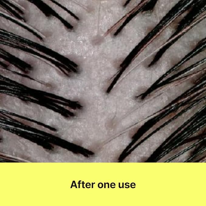 Kelp Hair Treatment Conditioner for Dry, Itchy & Sensitive Scalp, Nourishing and Hydrating, Strengthening and Repairing, Korean Hair Care, 16.9 fl oz / 500ml