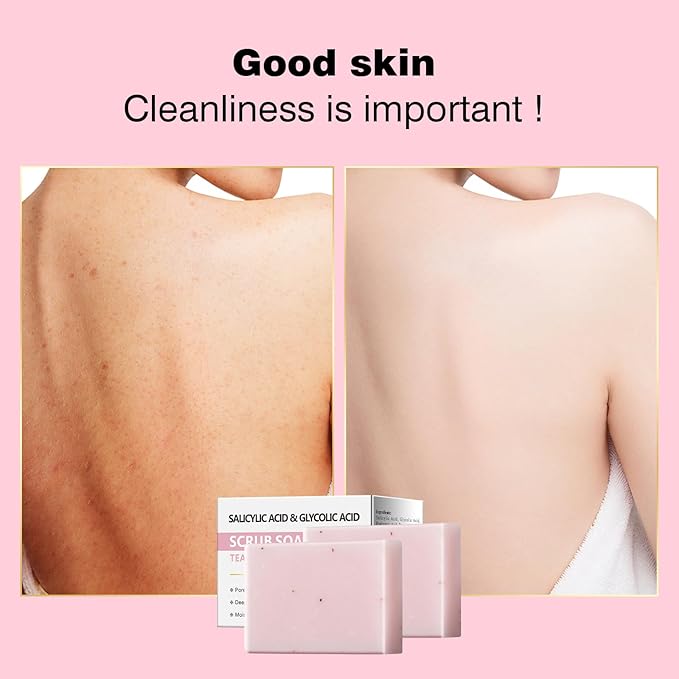 Salicylic Acid Scrub Soap, Face Bath Soap Bar with Glycolic Acid Tea Tree, Exfoliating Face Body Wash for Women & Men Anti-blemish Acne Strawberry Legs Ingrown Hair Keratosis Pilaris 200g/7OZ