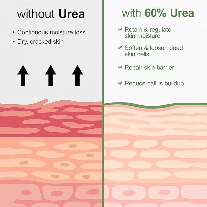 Urea Cream 60 Percent For Feet Maximum Strength Plus Salicylic Acid 2%, Tea Tree Foot Lotion For Dry Feet, Foot Cream Intensive Repair Foot Moisturizer 5.29oz