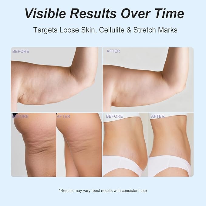 Overnight Toning Whip Cream – Dreamy Glow Skin Tightening & Anti-Cellulite Lotion for Body, Booty, Belly & Arms Firming Cream with Satin Mask 3.38 fl oz