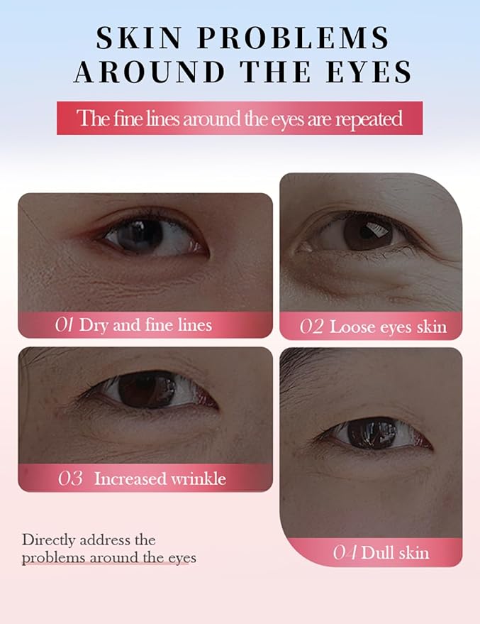 Under Eye Patches for Dark Circles - 80 PCS Eye Mask with Niacinamide, Collagen & Natural Extracts to Reduce Bags, Wrinkles, Fine Lines & Puffiness for Firmer, Elastic, Glowing Skin.