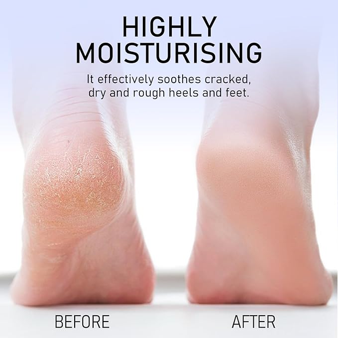 Crack Feet Prevention Stick, Moisturizing and Hydrating Foot and Hand Balm, Remove Dead Skin Softening and Nourishing Anti-Cracking Foot Cream for Feet Elbows Knees(1 PC, Pink)