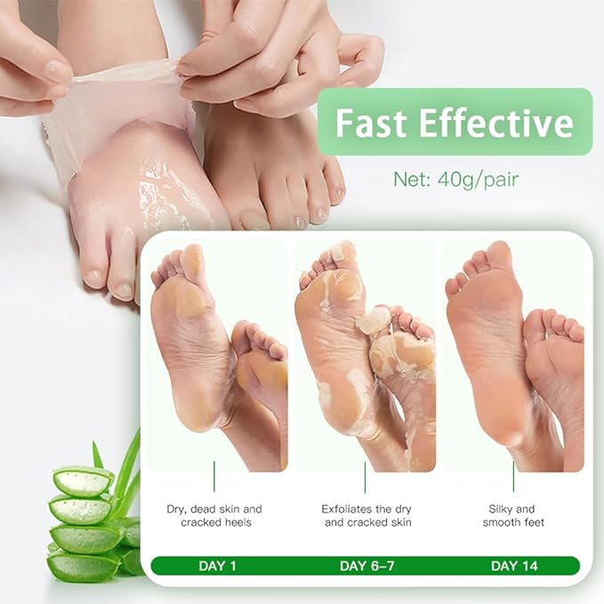 Dr.Pedi Foot Peeling Mask Exfoliating Foot Masks for Dry Dead Skin and Calluses Removal Aloe Vera Foot Spa Treatment for Soft Smooth Feet (5 Pairs)