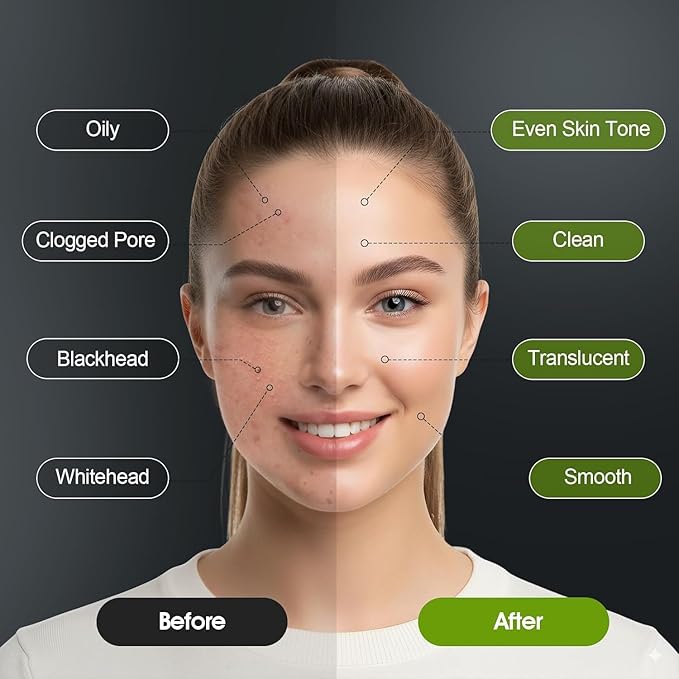 Blackhead Remover Mask – Black Head Remover for Face & Nose, Deep Pore Cleansing, Reduces Blackheads & Excess Oil, Refines Pores for All Skin Types(2.8 Ounce (Pack of 1), Aloe Vera)
