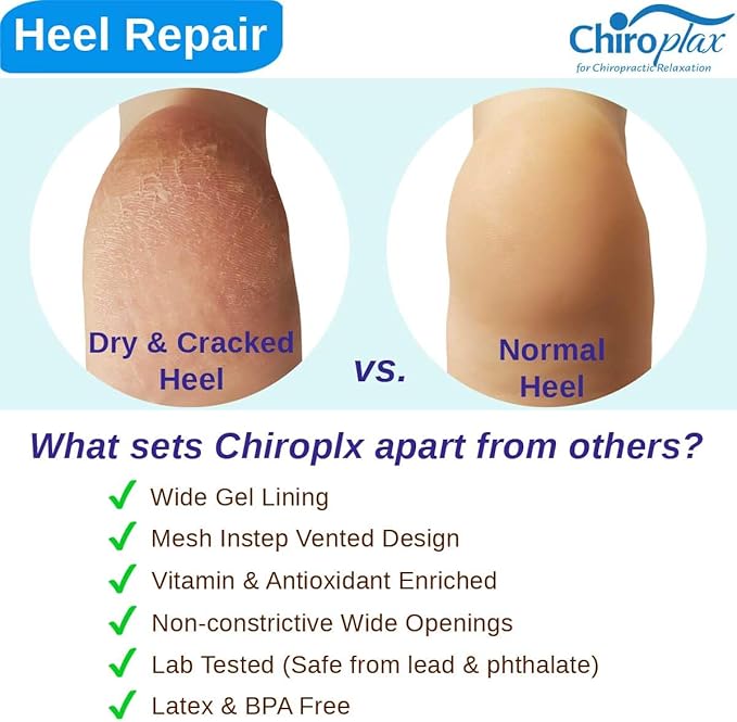 Chiroplax Vented Moisturizing Socks for Dry Cracked Heels Feet Treatment Gel Lined Spa to Repair Heal Soften Calluses Overnight, 2 Pairs (Black)