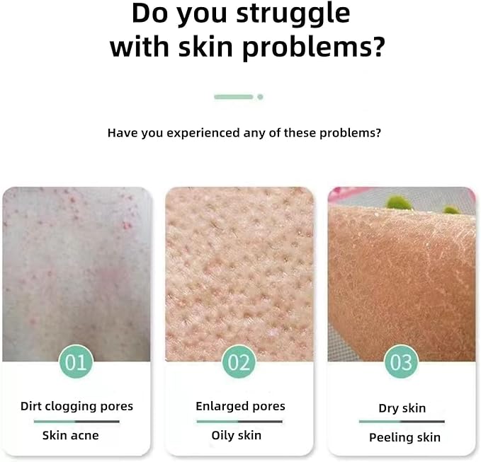 Exfoliating Body Scrubber for Shower, Smooth Skin, Eco Friendly Exfoliating Body Scrubber, Dead Skin Remover,Body Polish,Treatment of Keratosis Pilaris for Adults Child Unisex (3 Pack-Black)
