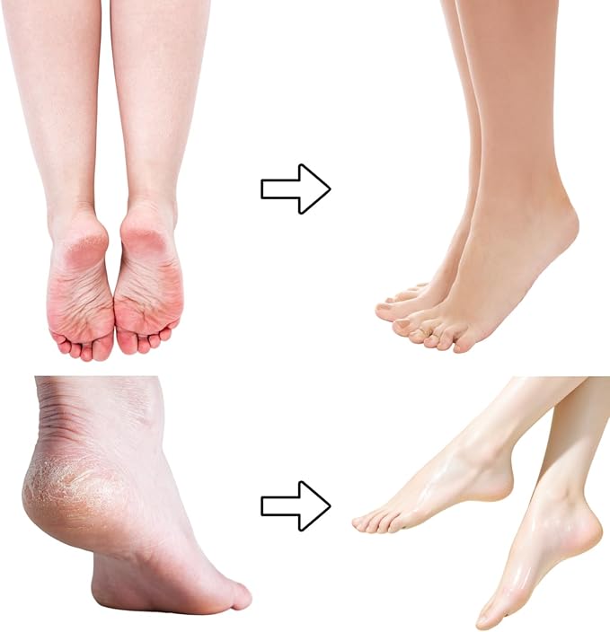 5 Pairs Hydrating Long Leg Foot Masks,Long Leg Foot Masque,Foot Peeling Mask,Moisturizing Nourishing Exfoliating Foot Mask for Women/Men