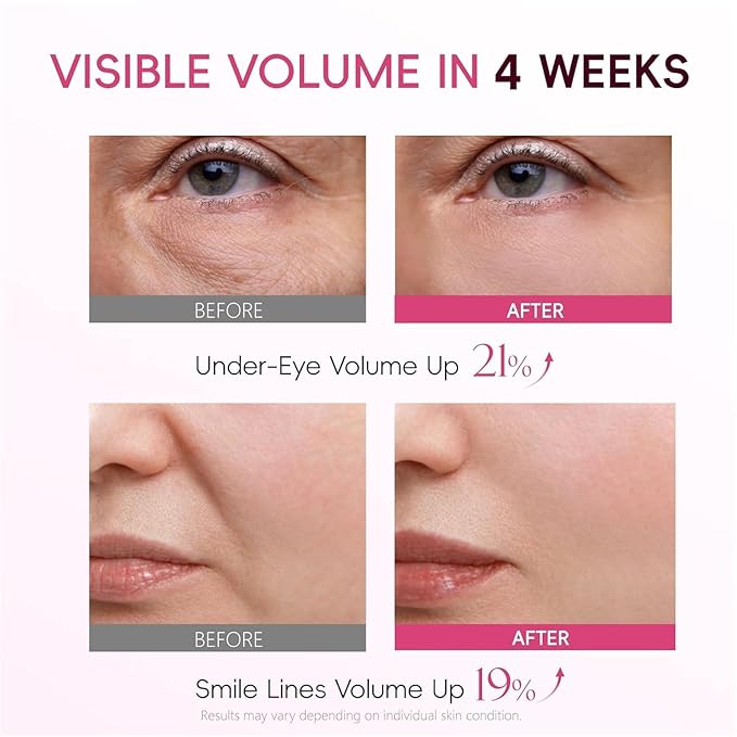 APBM Volufiline Plumping Serum for Face | 5% Volufiline + 3% Niacinamide + 1% Multi-Peptide | Visible Volume for Under-Eye & Smile Lines | For Fuller, Radiant-Looking Skin, Boost Collagen | 1.01 fl oz