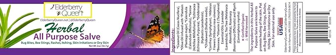 Elderberry Queen Healing Salve, All Purpose Anti Itch Herbal Balm for Dry Itchy Skin, Cracked Heels, Minor Burns, Sunburn, Chapped Lips (2 ounce)
