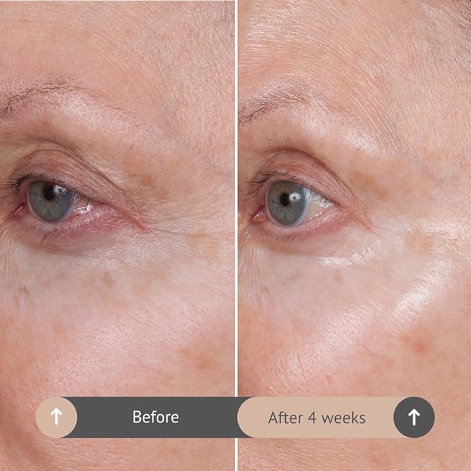 Consult Beaute VOLUMAGEN COLLAGEN EYE CREAM with Hyaluronic Acid, Hydrating, Skin Plumping - Targets Deep Under Eye Hollows, Visibly Smoothen Lines & Wrinkles 0.5 oz