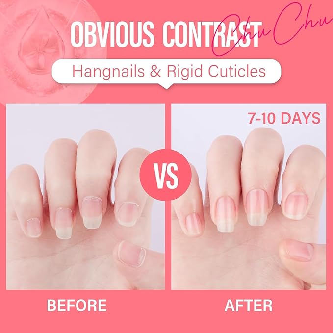 CHUCHU Vegan Cuticle Oil for Nail: Watermelon Scent Natural Vitamin B & E Nail Oil - Hydrates Moisturizes Repairs for Nails Damage Dry Cuticle 0.51 Fl Oz