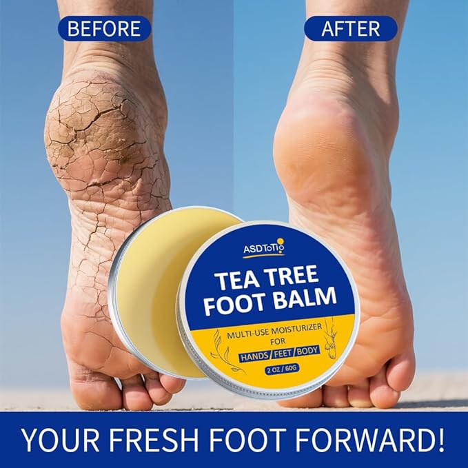 ASDToTio Tea Tree Foot Balm with Eucalyptus Oil for Cracked Heels, Extra Strength Moisturizer, 2 Fl Oz