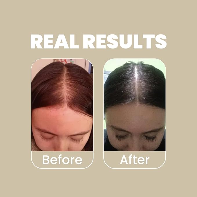 ANYELUZ Rosemary Shampoo and Conditioner Set - With Hyaluronic Acid and Natural Extracts, Strengthens and Hydrates Hair for Shine and Vitality - ¡Tu Cabello Fuerte!