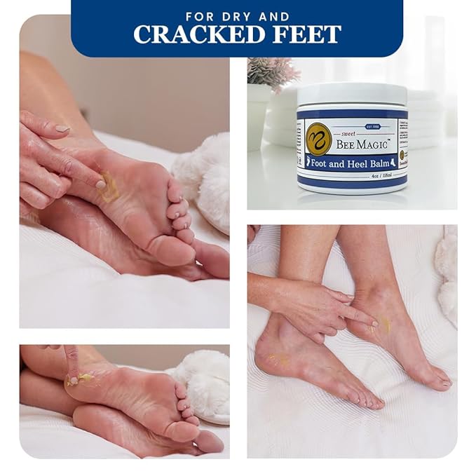 Sweet Bee Naturals Organic Foot Balm - Intensive Heel Balm for Dry Cracked Feet - Natural Moisturizing Treatment for Cracked Heels - Heel Cream Softener for Rough Skin Repair – 4 OZ Jar