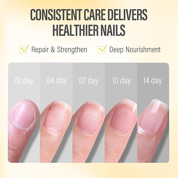 CHUCHU Vegan Cuticle Oil for Nails: Orange Jojoba Nail Cuticle Oil with Vitamin B & E for Moisturizes Cuticle and Nail's Skin - Prevents Hangnails and Chapped 15ML