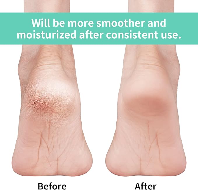 Vaincre Gel Moisturizing Heel Socks for Dry Cracked Feet Women, 4 Pairs Foot Care Spa Moisture Toeless Socks for Cracked Heel Repair Treatment Overnight (Regular)