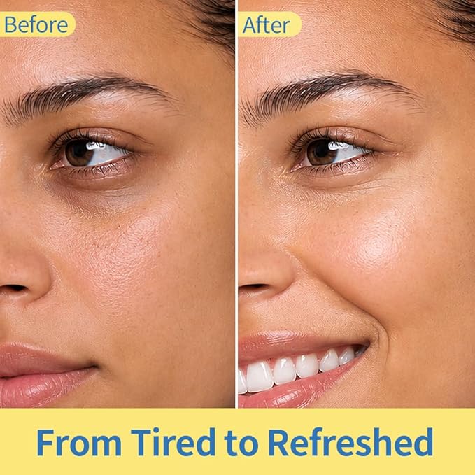 Purederm Revitalizing Eye Gel – Cooling Under Eye Serum Roller with Caffeine and 5% Volufiline – Depuffing Puffy Eyes, Dark Circles & Fine Lines – Daily Use, 0.88 oz