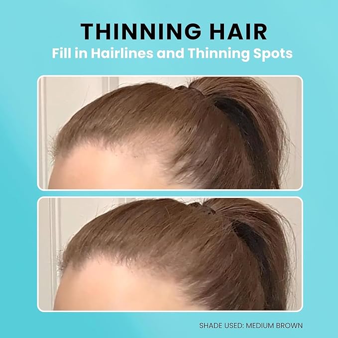 SURETHIK 4-in-1 Premium Hairline Powder Kit - Conceal Thinning Hair, Root Touch-Up, Highlight Refresher & Eyebrow Enhancer for Men and Women (Blonde)