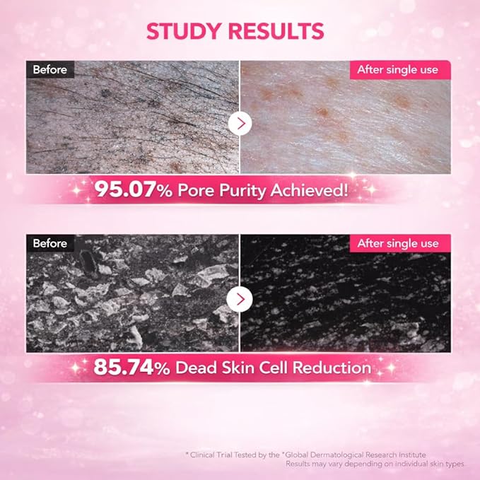 Facial Cleanser PDRN Marshmallow Whip Cleanser | Deep Cleansing Foam for Pore Care, Blackhead Care, Uneven Skin Tone with Salmon DNA PDRN, Low pH Hydrating and Nourishing Face Wash