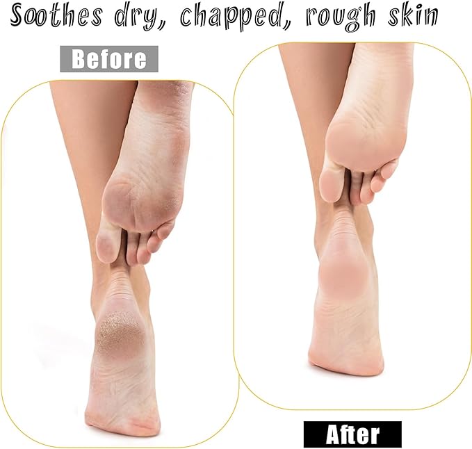 5 Pairs Spa White Cotton Socks Moisturizing Socks Overnight Reusable Lotion Sock Absorbing Soft Moisture Foot Heel Sleeping Sock for Women Men Dry Cracked Feet Beauty Pedicure