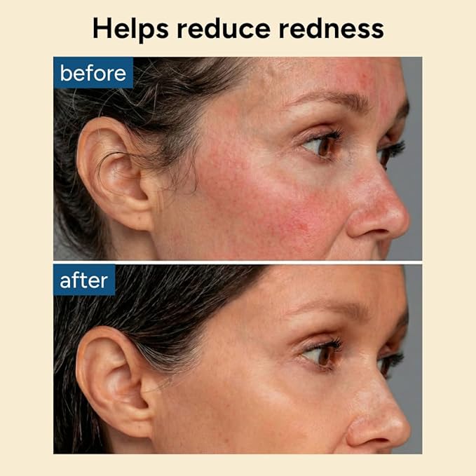 Collagen Gel Mask, Hydrogel for Reducing Redness, Sunburn & After Sun Care, Hydration, Soothing, Moisturizing, Made in Korea, 4 Sheets (Hydro Soothe)