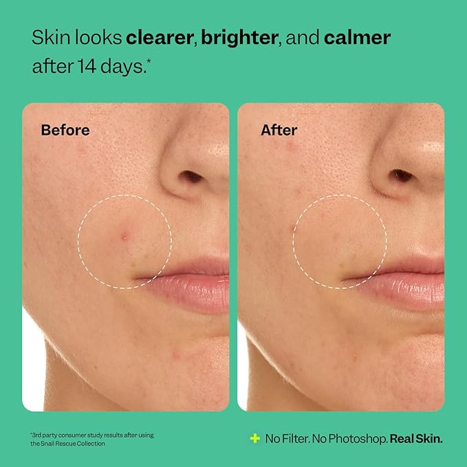 Peach Slices - Snail Rescue Purifying Cleanser (4.05 oz) - Snail Mucin Concentrate - Cleanse & Refresh Skin - Pine Bark, Hyaluronic Acid & Cica - Clean & Cruelty Free - Korean Skin Care & Beauty