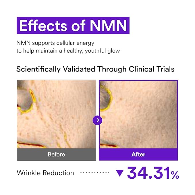 VEGANIFECT NMN Collagen Cream | Hydrating & Firming Moisturizer with Peptides & Glutathione & Hyaluronic Acid | Boosts Elasticity & Wrinkle Care | Korean Skincare, 1.69 fl.oz