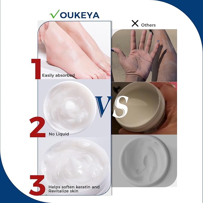 OUKEYA Urea Cream 40 Percent for Feet, Maximum Strength Moisturizer, Intensive Hydrating Foot Cream for Dry Cracked Skin, Softens Rough Heels, Knees & Elbows, 5.29 oz