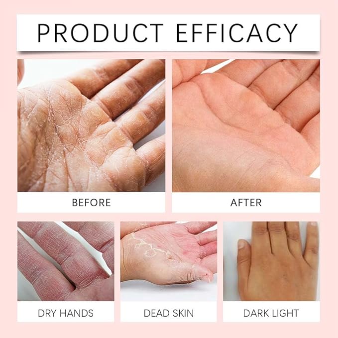 Retinol Hand Cream Anti Aging, Enriched With Collagen, It is Specially Formulated for Aging, Dry, And Chapped Hands (100G Anti Aging Hand Cream, Nourishing and Protecting Skin, Nails, And Cuticles)