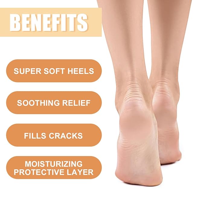 NovaCharm 2PCS Urea Cream 60 Percent for Feet, Maximum Strength Urea Foot Cream Stick, Foot Moisturizer Lotion for Cracked Heels, Dry Hands & Rough Knees (1.4Ounce(Pack of 2), Honey)