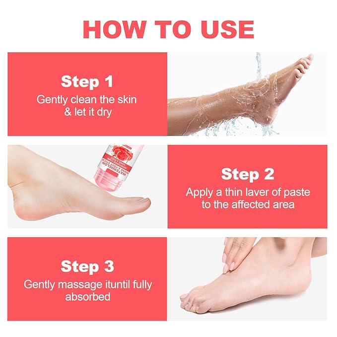 60% Urea Cream Foot Hand Cream Stick for Cracked Hands Elbows Feet Knees, Repairing Restore Balm for Dry & Dead Skin, Hydrates & Nourish Foot Care for Women & Men (Watermelon, 1.41 oz)