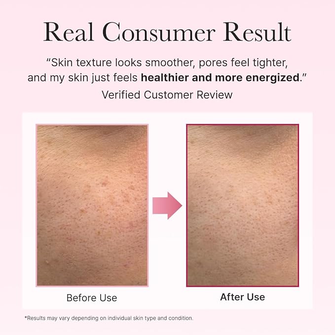Arencia PDRN Booster Shot Serum, Rosy-PDRN & Peptides for Glowy, Healthy Skin, 30ml/1.01 fl oz