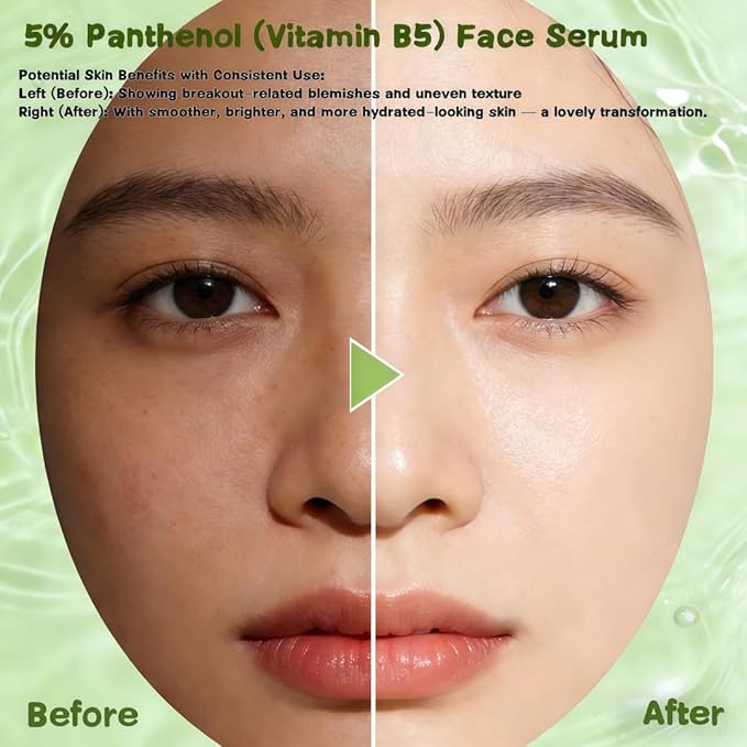 5% Panthenol (Vitamin B5) Face Serum | Sensitive Skin Barrier Support, Hydrating Soothing Serum for Dry Skin, Strengthen Skin Barrier & Soothe Redness, Fragrance-Free for Delicate & Acne-Prone Skin