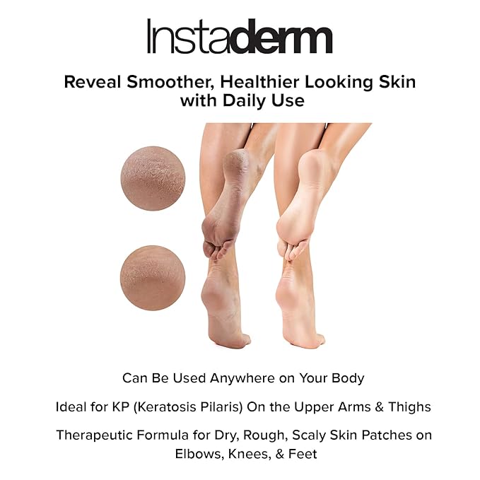 Keratosis Pilaris Treatment- KP Bump Eraser. Smoothing Exfoliating Moisturizing Lotion for Rough, Dry, Flakey & Bumpy Skin Conditions with Lactic Acid, AHA. Smooth Skin Body Cream.