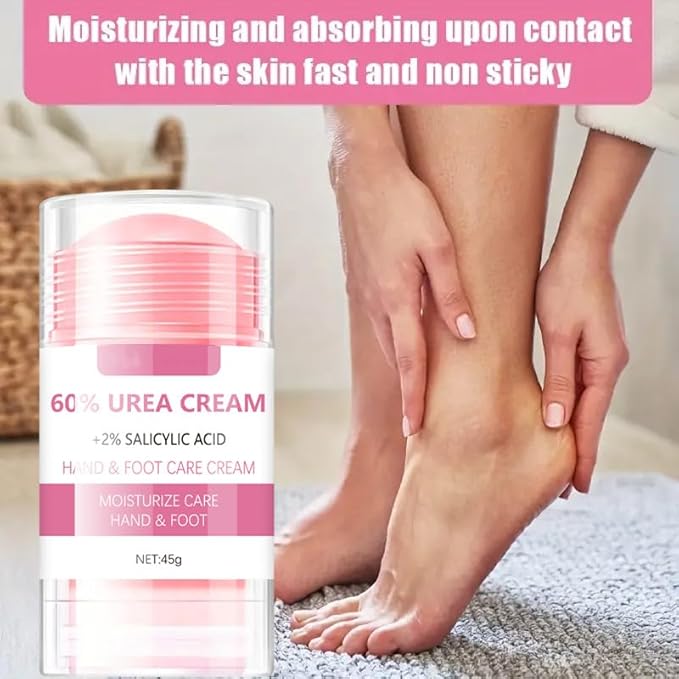 Grospe 60% Urea plus 2% Salicylic Acid Hand and Foot Cream, Peach Scented Hand and Foot Moisturizer for Rough and Dry Cracked Hands, Elbows, Feet and Heels, Exfoliating Repair Balm, 1.58 OZ