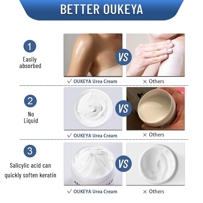 OUKEYA Urea Cream 42% plus Salicylic Acid 2% for Dry Cracked Feet, Heel, Knees, Elbows, Hands – Intensive Moisturizing Cream for Very Rough Skin, 5.29 oz, Pack of 2