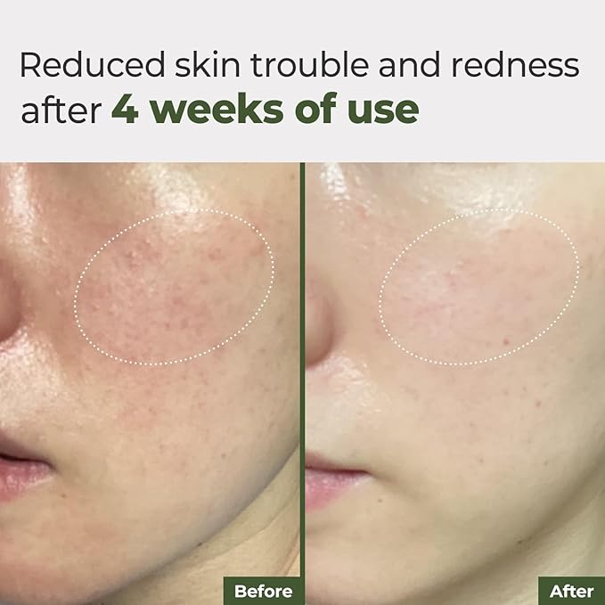 Rbfy. Daily Ampoule Pad (100 Pads) – Korean Facial Toner Pads with Pure Cica Complex, Soothing, Redness Relief & Hydrating, Gentle for Dry, Stressed, and Sensitive Skin, Korean Skincare.
