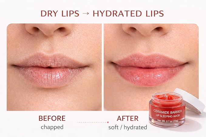 EVYRA Ceramide Barrier Lip Sleeping Mask 20g – Overnight Lip Repair for Very Dry & Chapped Lips – Peach Flavor – Lanolin & Petrolatum Free Lip Treatment