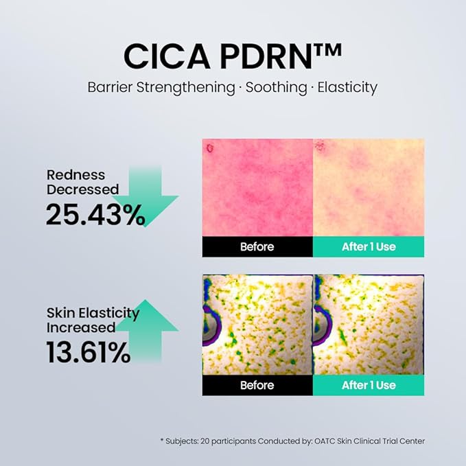 beplain Cica PDRN Skin Booster Face Serum | Hydrating Barrier Care for Sensitive Skin | Firming & Elasticity Serum | Korean Skincare (30ml / 1.01 fl oz)