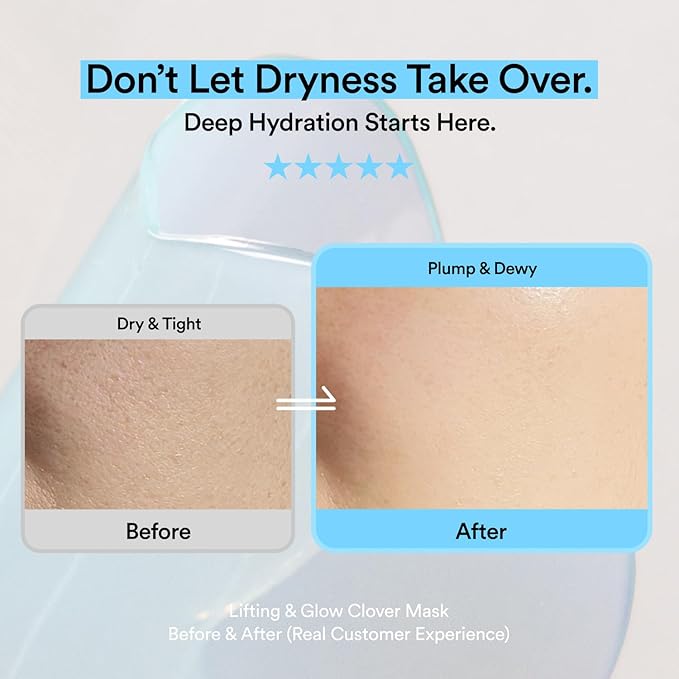 Skit Hydrating & Moisture Face Gel Patch | Hyaluronic Acid Hydrogel Patches with Glyceryl Glucoside for Deep Hydration & Soothing Care, Targeted Clover Mask, Korean Skincare | 4 Sets (8 Patches)