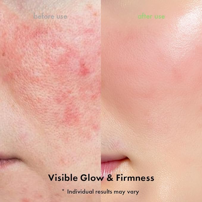 PORE RESET PEELING AMPOULE