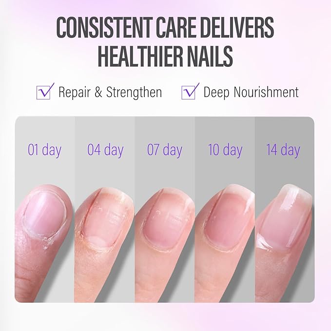 CHUCHU Nail Growth and Strengthener Oil for Cuticle - Repair Moisturizing Treatment - Natural Jojoba Vitamin B & E Nail Oil for Dry Cracked Nails (Lavender 01)