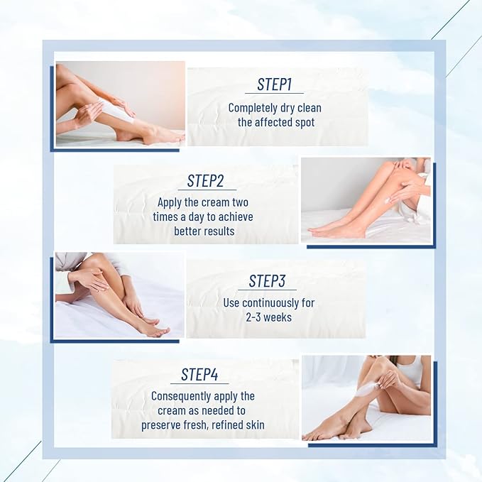 Urea Cream,40% Foot Care lotion for chapped heels, chapped heels, super, rough, dry, calloused feet, soften rough skin on feet 5.29 fl.oz for all skin
